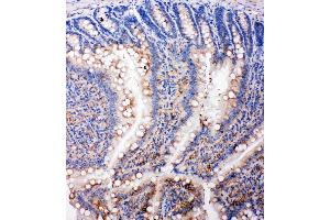 Image no. 2 for anti-SMAD, Mothers Against DPP Homolog 5 (SMAD5) (AA 248-267), (Middle Region) antibody (ABIN3043980)