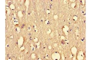 Immunohistochemistry of paraffin-embedded human brain tissue using ABIN7165071 at dilution of 1:100