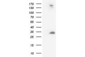 Image no. 7 for anti-Deoxycytidine Kinase (DCK) antibody (ABIN1497775)