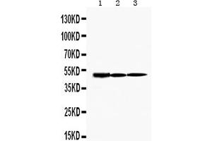Image no. 3 for anti-Hepatitis A Virus Cellular Receptor 1 (HAVCR1) (AA 289-307), (C-Term) antibody (ABIN3044229)