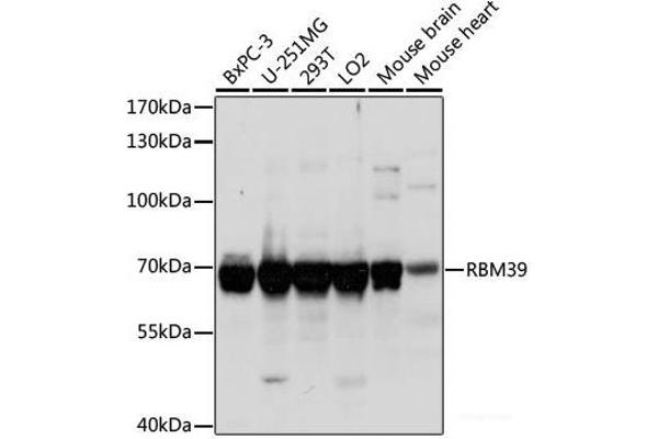 RBM39 anticorps