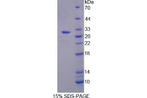 Image no. 1 for POU domain, class 2, transcription factor 2 (POU2F2) (AA 49-288) protein (His tag) (ABIN6238489)