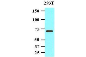 Image no. 1 for anti-Protein Phosphatase, Mg2+/Mn2+ Dependent, 1G (PPM1G) (AA 317-546) antibody (ABIN933745)