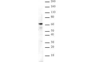 Image no. 1 for anti-IKAROS Family Zinc Finger 3 (Aiolos) (IKZF3) (C-Term) antibody (ABIN6971379)