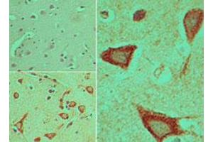 Image no. 1 for anti-Dishevelled, Dsh Homolog 3 (Drosophila) (DVL3) (AA 560-610) antibody (ABIN960145)