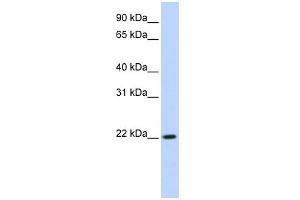 DPCD 抗体  (Middle Region)