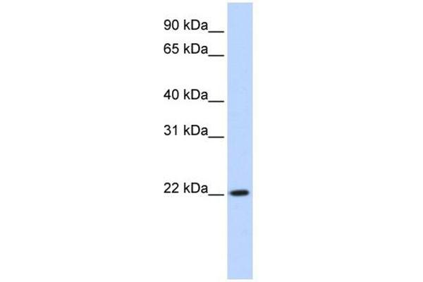 anti-Deleted in Primary Ciliary Dyskinesia Homolog (DPCD) (Middle Region) antibody