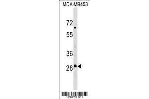 Image no. 1 for anti-Membrane-Associated Ring Finger (C3HC4) 3, E3 Ubiquitin Protein Ligase (MARCH3) (AA 224-251), (C-Term) antibody (ABIN1536881)