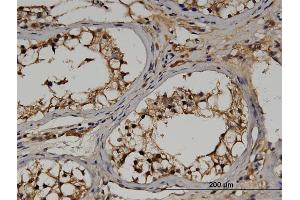 Immunoperoxidase of monoclonal antibody to RGS14 on formalin-fixed paraffin-embedded human testis.
