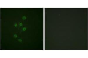 Immunofluorescence analysis of A549 cells, using HDAC3 (Phospho-Ser424) Antibody.