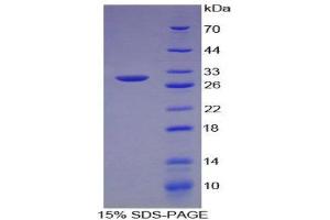Image no. 1 for Intelectin 1 (Galactofuranose Binding) (ITLN1) (AA 31-253) protein (His tag) (ABIN1879060)