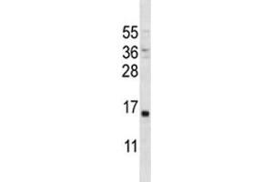 Image no. 2 for anti-Parathyroid Hormone (PTH) (AA 59-88) antibody (ABIN3028915)