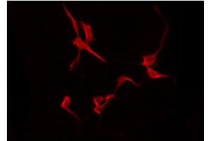 Image no. 2 for anti-Microtubule-Associated Protein 2 (MAP2) (AA 1819-1823) antibody (ABIN6267762)