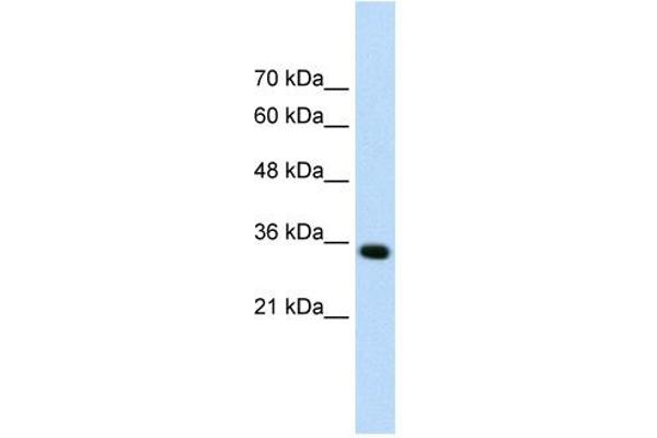 anti-ADAM Metallopeptidase with Thrombospondin Type 1 Motif, 4 (ADAMTS4) (N-Term) antibody