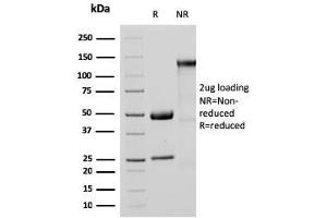 Image no. 4 for anti-Methylthioadenosine phosphorylase (MTAP) (AA 97-196) antibody (ABIN6940089)