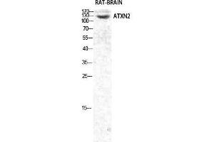 Image no. 2 for anti-Ataxin 2 (ATXN2) (Internal Region) antibody (ABIN3183407)