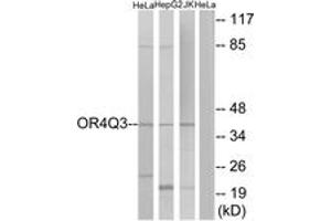 Image no. 1 for anti-Olfactory Receptor, Family 4, Subfamily Q, Member 3 (OR4Q3) (AA 264-313) antibody (ABIN1535918)