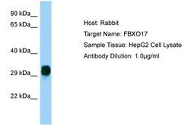anti-F-Box Protein 17 (FBXO17) (AA 36-85) antibody