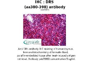 Image no. 2 for anti-Tumor Necrosis Factor Receptor Superfamily, Member 10b (TNFRSF10B) (AA 380-398) antibody (ABIN1733771)