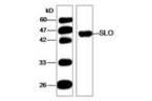 Image no. 1 for anti-Streptolysin O (SLO) (AA 78-206) antibody (ABIN791623)