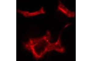 Image no. 1 for anti-RAB1B, Member RAS Oncogene Family (RAB1B) antibody (ABIN6264562)