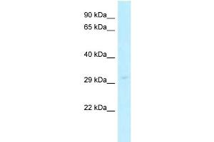 anti-Solute Carrier Family 25 (Mitochondrial Carrier, Ornithine Transporter) Member 15 (SLC25A15) (N-Term) antibody