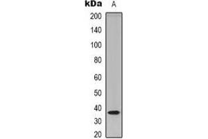Image no. 2 for anti-Trans-2,3-Enoyl-CoA Reductase (TECR) (C-Term) antibody (ABIN2957774)