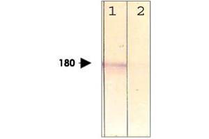 Image no. 1 for anti-Low Density Lipoprotein Receptor-Related Protein 6 (LRP6) (pThr1479) antibody (ABIN540939)