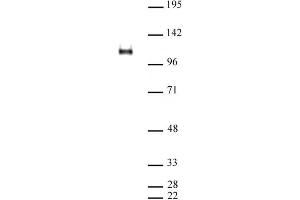 Image no. 4 for anti-CCCTC-Binding Factor (Zinc Finger Protein) (CTCF) (N-Term) antibody (ABIN2668282)
