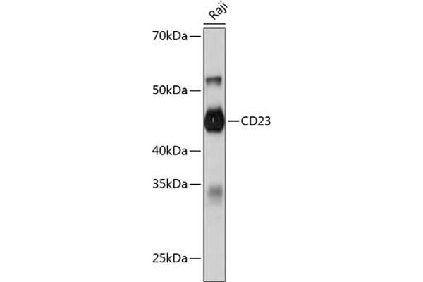 FCER2 antibody