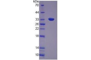 Image no. 1 for Utrophin (UTRN) (AA 1-252) protein (His tag) (ABIN6238583)