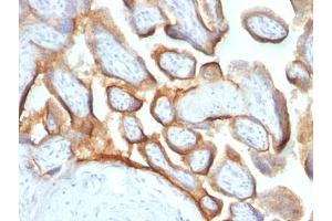Image no. 1 for anti-HCG beta antibody (ABIN3026935)