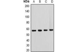 Image no. 3 for anti-T-Box 5 (TBX5) antibody (ABIN2966725)