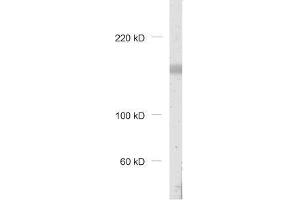Image no. 2 for anti-Protein-Kinase, Interferon-Inducible Double Stranded RNA Dependent Inhibitor, Repressor of (p58 Repressor) (PRKRIR) antibody (ABIN2850871)