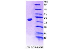 Image no. 1 for Nucleoporin 35kDa (NUP35) (AA 132-310) protein (His tag) (ABIN1878350)