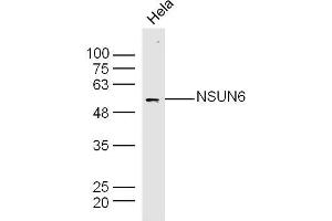 Image no. 1 for anti-NOP2/Sun Domain Family, Member 6 (NSUN6) (AA 51-150) antibody (ABIN2808292)