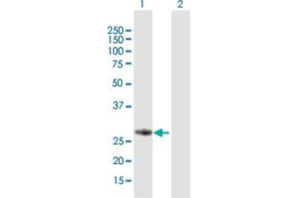 anti-F-Box Protein 17 (FBXO17) (AA 1-278) antibody