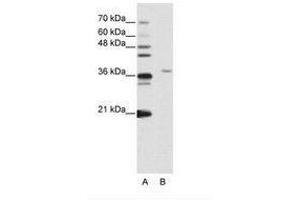 Image no. 2 for anti-Squamous Cell Carcinoma Antigen Recognized By T Cells 3 (SART3) (N-Term) antibody (ABIN203084)