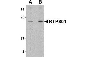 Image no. 1 for anti-DNA-Damage-Inducible Transcript 4 (DDIT4) (Middle Region) antibody (ABIN1031074)