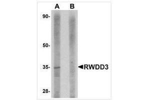 Image no. 1 for anti-RWD Domain Containing 3 (RWDD3) (C-Term) antibody (ABIN783830)