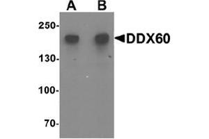 Image no. 1 for anti-DEAD (Asp-Glu-Ala-Asp) Box Polypeptide 60 (DDX60) (Middle Region) antibody (ABIN1450010)
