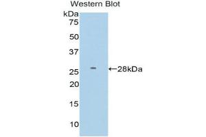 Image no. 1 for anti-Farnesyl-Diphosphate Farnesyltransferase 1 (FDFT1) (AA 187-416) antibody (ABIN1858845)