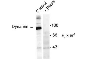 Image no. 1 for anti-Dynamin 1 (DNM1) (pSer774) antibody (ABIN361464)