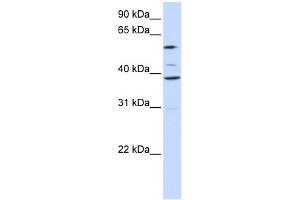 Image no. 1 for anti-Solute Carrier Family 25 (Mitochondrial Carrier, Graves Disease Autoantigen), Member 16 (SLC25A16) (Middle Region) antibody (ABIN2781728)