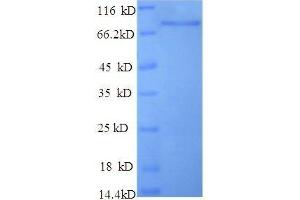 p53 Protein (His-SUMO Tag)
