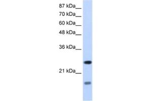 Image no. 1 for anti-Signal Recognition Particle 14kDa (Homologous Alu RNA Binding Protein) (SRP14) antibody (ABIN2462140)