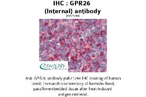 Image no. 2 for anti-G Protein-Coupled Receptor 26 (GPR26) (Internal Region) antibody (ABIN1735038)