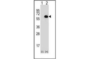 Image no. 2 for anti-Glycerol Kinase (GK) (AA 23-51), (N-Term) antibody (ABIN952545)