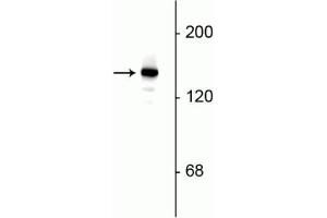 Image no. 1 for anti-Synaptojanin 1 (SYNJ1) (C-Term) antibody (ABIN6254054)