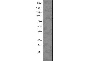 Image no. 3 for anti-Chloride Channel 3 (CLCN3) antibody (ABIN6260874)